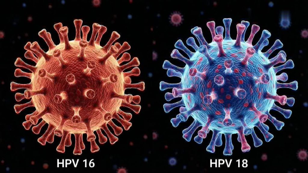 بهترین روش درمان HPV نوع 16 و 18